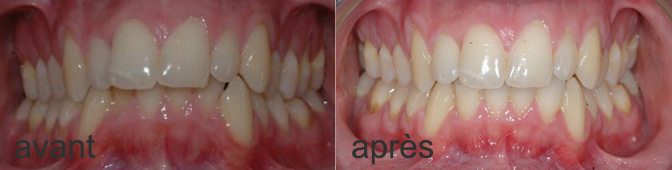 Résultat aerodontis homme de 28 ans