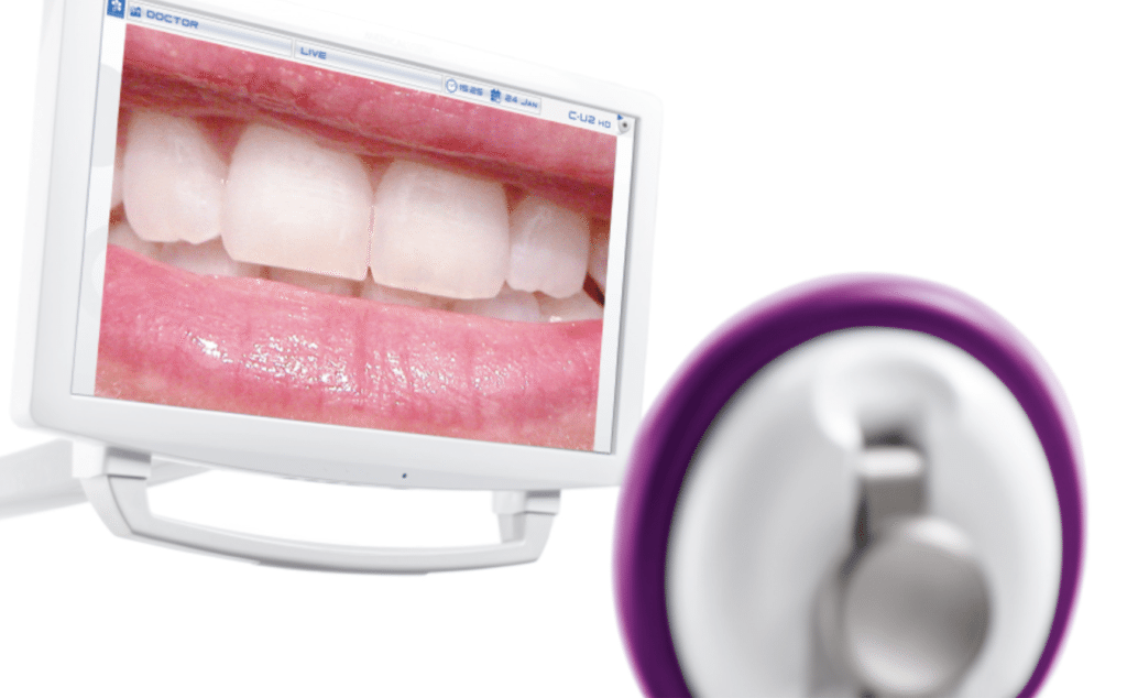 Caméra intra-orale C-U2 HD - Myray