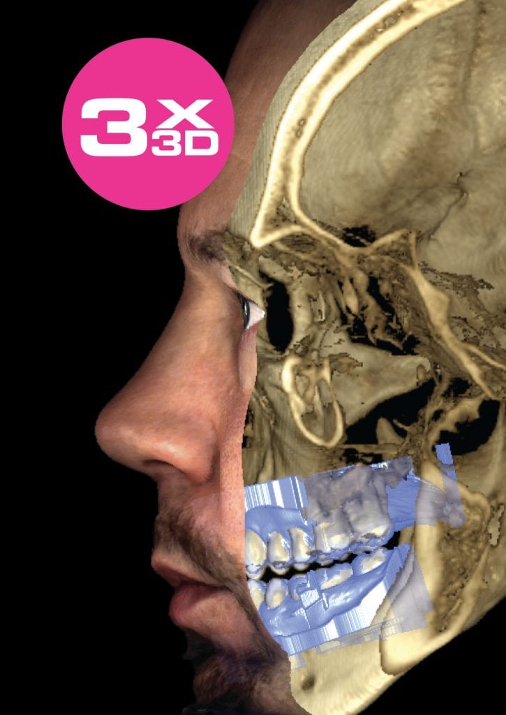 Cone Beam Planmeca ProMax 3D - Planmeca