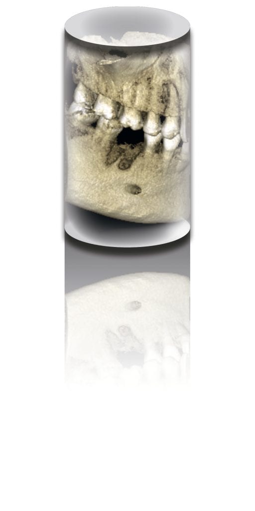 Cone Beam Planmeca ProMax 3D - Planmeca